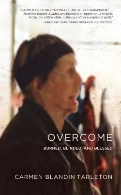 Pokonany: Spalony, oślepiony i błogosławiony - Overcome: Burned, Blinded, and Blessed