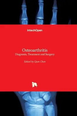 Choroba zwyrodnieniowa stawów: Diagnoza, leczenie i chirurgia - Osteoarthritis: Diagnosis, Treatment and Surgery