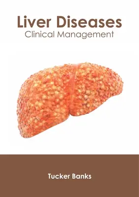 Choroby wątroby: Zarządzanie kliniczne - Liver Diseases: Clinical Management