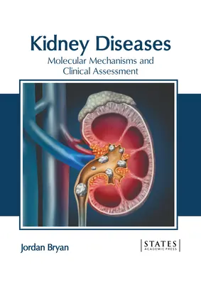 Choroby nerek: Mechanizmy molekularne i ocena kliniczna - Kidney Diseases: Molecular Mechanisms and Clinical Assessment