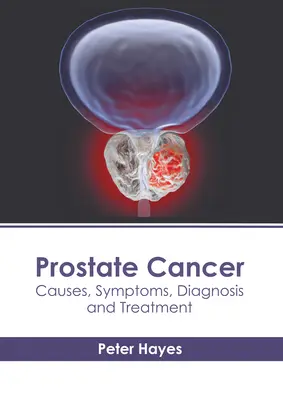 Rak prostaty: Przyczyny, objawy, diagnoza i leczenie - Prostate Cancer: Causes, Symptoms, Diagnosis and Treatment