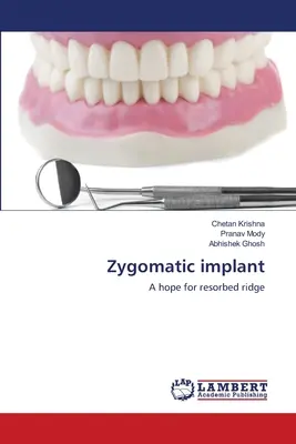 Implant jarzmowy - Zygomatic implant