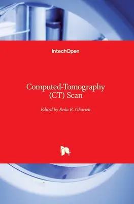 Tomografia komputerowa (CT) - Computed-Tomography (CT) Scan