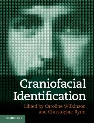 Identyfikacja czaszkowo-twarzowa - Craniofacial Identification