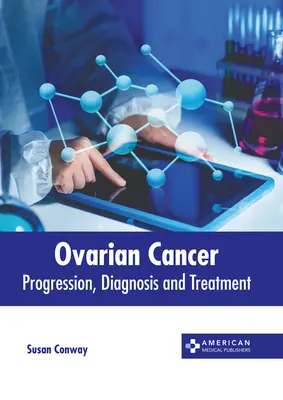 Rak jajnika: Postęp, diagnoza i leczenie - Ovarian Cancer: Progression, Diagnosis and Treatment