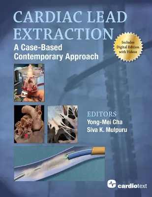 Ekstrakcja elektrod kardiologicznych: Współczesne podejście oparte na przypadkach - Cardiac Lead Extraction: A Case-Based Contemporary Approach