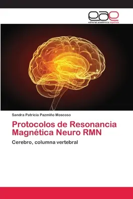 Protokoły rezonansu magnetycznego Neuro RMN - Protocolos de Resonancia Magntica Neuro RMN