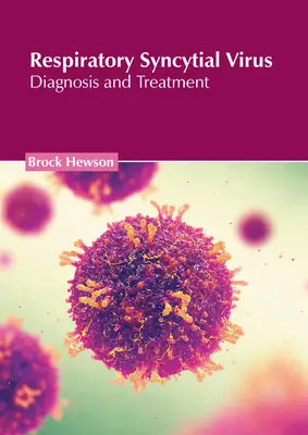 Syncytialny wirus oddechowy: Diagnostyka i leczenie - Respiratory Syncytial Virus: Diagnosis and Treatment