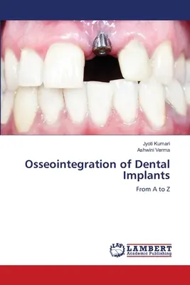 Osseointegracja implantów stomatologicznych - Osseointegration of Dental Implants