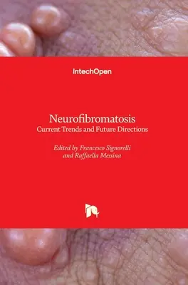 Neurofibromatoza: Aktualne trendy i przyszłe kierunki - Neurofibromatosis: Current Trends and Future Directions