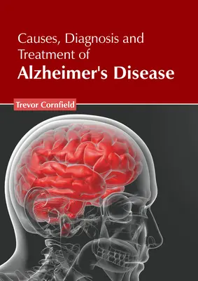 Przyczyny, diagnoza i leczenie choroby Alzheimera - Causes, Diagnosis and Treatment of Alzheimer's Disease