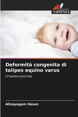 Deformacja wrodzona talipes equino varus - Deformit congenita di talipes equino varus