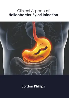 Kliniczne aspekty zakażenia Helicobacter Pylori - Clinical Aspects of Helicobacter Pylori Infection