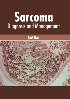 Mięsak: Diagnoza i zarządzanie - Sarcoma: Diagnosis and Management