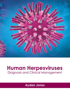 Ludzkie herpeswirusy: Diagnostyka i postępowanie kliniczne - Human Herpesviruses: Diagnosis and Clinical Management