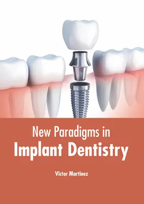 Nowe paradygmaty w stomatologii implantologicznej - New Paradigms in Implant Dentistry