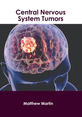 Guzy ośrodkowego układu nerwowego - Central Nervous System Tumors