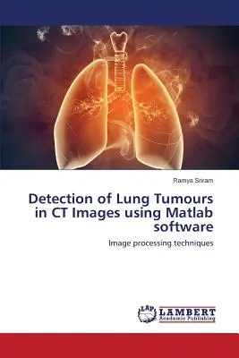 Wykrywanie guzów płuc w obrazach TK przy użyciu oprogramowania Matlab - Detection of Lung Tumours in CT Images using Matlab software