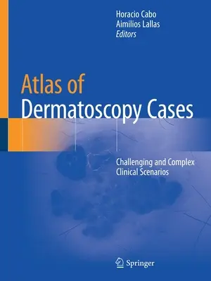 Atlas przypadków dermatoskopii: Trudne i złożone scenariusze kliniczne - Atlas of Dermatoscopy Cases: Challenging and Complex Clinical Scenarios