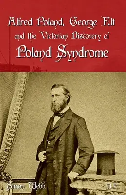 Alfred Poland, George Elt i wiktoriańskie odkrycie syndromu polskiego - Alfred Poland, George Elt and the Victorian Discovery of Poland Syndrome