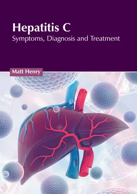 Wirusowe zapalenie wątroby typu C: Objawy, diagnoza i leczenie - Hepatitis C: Symptoms, Diagnosis and Treatment