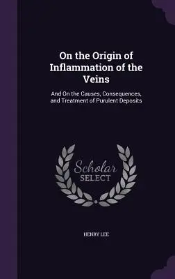 O pochodzeniu zapalenia żył: O przyczynach, konsekwencjach i leczeniu ropnych złogów - On the Origin of Inflammation of the Veins: And On the Causes, Consequences, and Treatment of Purulent Deposits