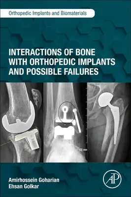 Interakcje kości z implantami ortopedycznymi i możliwe awarie - Interactions of Bone with Orthopedic Implants and Possible Failures