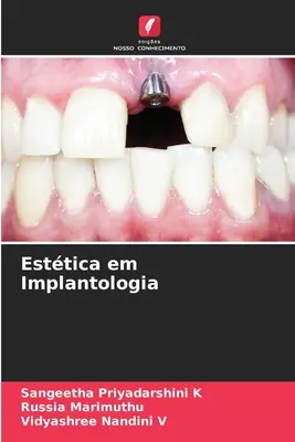 Estetyka w implantologii - Esttica em Implantologia