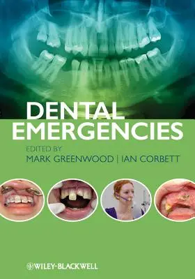 Nagłe przypadki stomatologiczne - Dental Emergencies