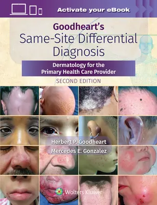 Diagnoza różnicowa Goodheart's Same-Site: Dermatologia dla lekarza podstawowej opieki zdrowotnej - Goodheart's Same-Site Differential Diagnosis: Dermatology for the Primary Health Care Provider