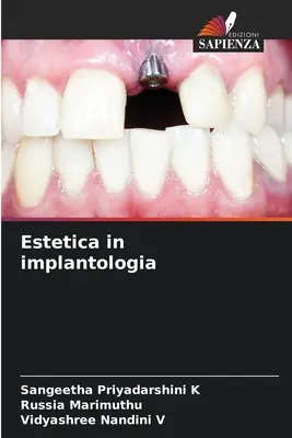 Estetyka w implantologii - Estetica in implantologia