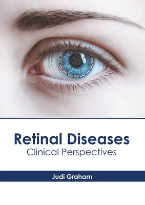 Choroby siatkówki: Perspektywy kliniczne - Retinal Diseases: Clinical Perspectives