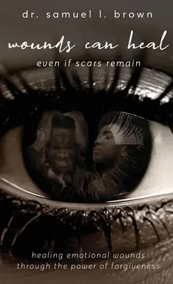 Rany mogą się zagoić, Leczenie ran emocjonalnych poprzez moc przebaczenia - Wounds Can Heal, Healing Emotional Wounds Through the Power of Forgiveness