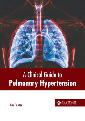 Przewodnik kliniczny po nadciśnieniu płucnym - A Clinical Guide to Pulmonary Hypertension