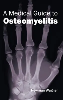 Przewodnik medyczny po zapaleniu kości i szpiku - Medical Guide to Osteomyelitis