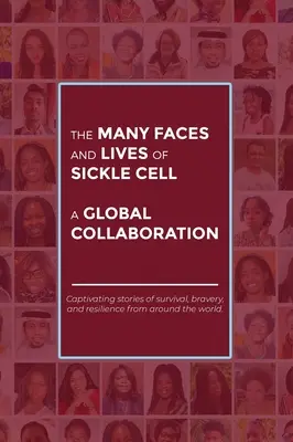 Różnorodne oblicza i życie osób z komórkami Sickle'a - globalna współpraca - The Many Faces and Lives of Sickle Cell - A Global Collaboration