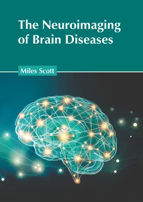 Neuroobrazowanie chorób mózgu - The Neuroimaging of Brain Diseases