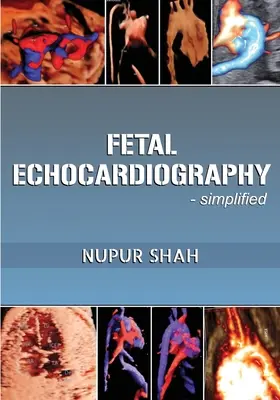 Echokardiografia płodowa - uproszczona - Fetal Echocardiography - Simplified