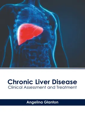 Przewlekła choroba wątroby: Ocena kliniczna i leczenie - Chronic Liver Disease: Clinical Assessment and Treatment