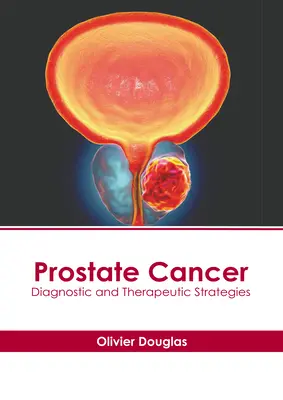 Rak prostaty: Strategie diagnostyczne i terapeutyczne - Prostate Cancer: Diagnostic and Therapeutic Strategies