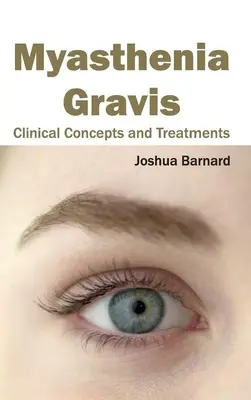 Myasthenia Gravis: koncepcje kliniczne i leczenie - Myasthenia Gravis: Clinical Concepts and Treatments