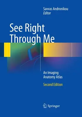 See Right Through Me: Atlas anatomii obrazowej - See Right Through Me: An Imaging Anatomy Atlas