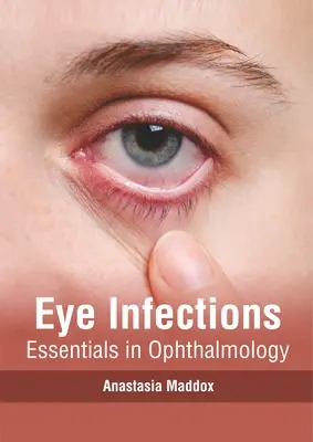 Infekcje oka: Podstawy okulistyki - Eye Infections: Essentials in Ophthalmology