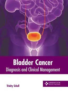 Rak pęcherza moczowego: Diagnoza i postępowanie kliniczne - Bladder Cancer: Diagnosis and Clinical Management