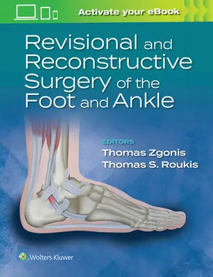 Chirurgia rewizyjna i rekonstrukcyjna stopy i stawu skokowego - Revisional and Reconstructive Surgery of the Foot and Ankle