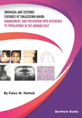 Orofacjalne i ogólnoustrojowe cechy talasemii major: Zarządzanie i zapobieganie w odniesieniu do populacji w Zatoce Arabskiej - Orofacial and Systemic Features of Thalassemia Major: Management, and Prevention with Reference to Populations in the Arabian Gulf