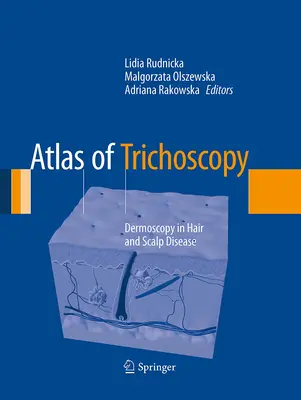 Atlas trichoskopii: Dermoskopia w chorobach włosów i skóry głowy - Atlas of Trichoscopy: Dermoscopy in Hair and Scalp Disease