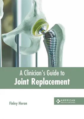 Przewodnik klinicysty po wymianie stawów - A Clinician's Guide to Joint Replacement