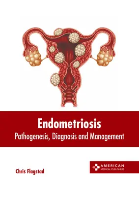 Endometrioza: Patogeneza, diagnostyka i leczenie - Endometriosis: Pathogenesis, Diagnosis and Management