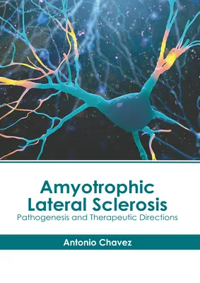 Stwardnienie zanikowe boczne: Patogeneza i kierunki terapeutyczne - Amyotrophic Lateral Sclerosis: Pathogenesis and Therapeutic Directions